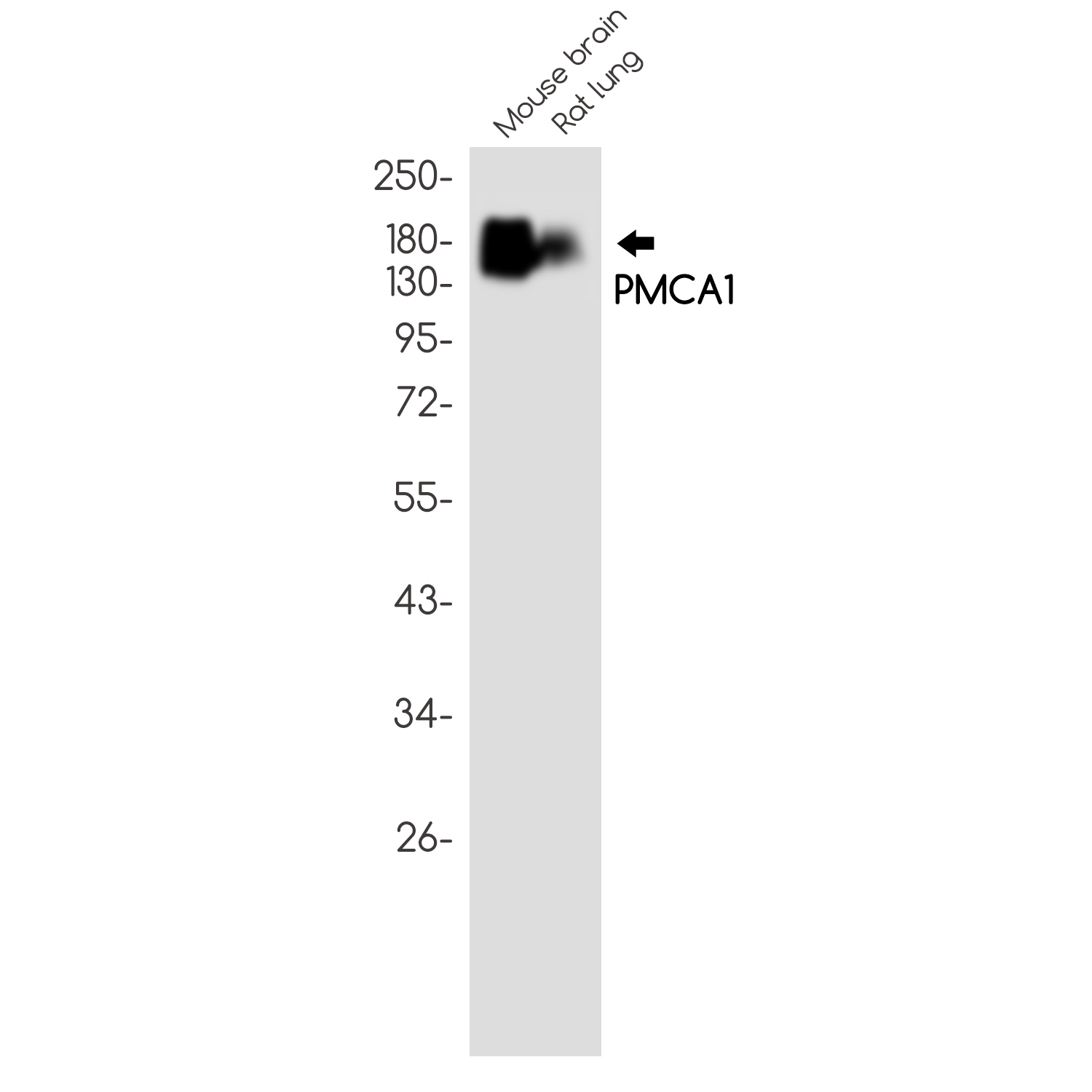 PMCA1 Rabbit mAb